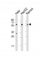 GRK5 Antibody (C-term)